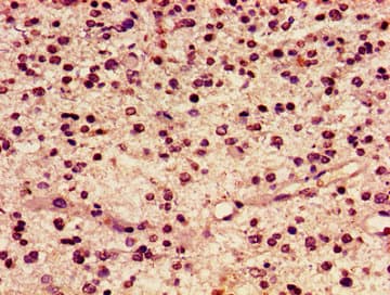 HIST1H2AI Antibody