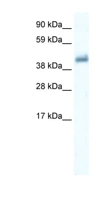 Polyclonal Rabbit anti-Human GABRE Antibody (aa237-286, IHC, WB)