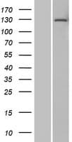 DNTTIP2 Protein (Over-Expression Lysate Myc-DDK (Flag))