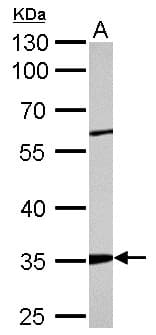 Polyclonal Rabbit anti-Human ARPC2 / p34-Arc Antibody (aa14-300, IHC, WB)