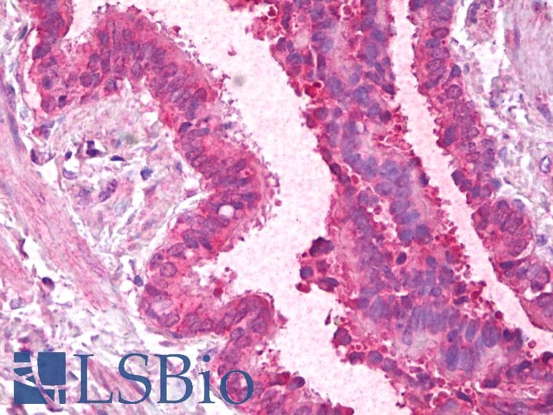 IHC-plus™ Polyclonal Goat anti-Human HnRNP-E1 / PCBP1 Antibody (aa234-247, IHC, WB)