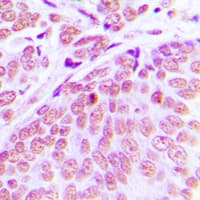 Polyclonal Rabbit anti-Human CEP70 Antibody (Internal, IHC, WB)