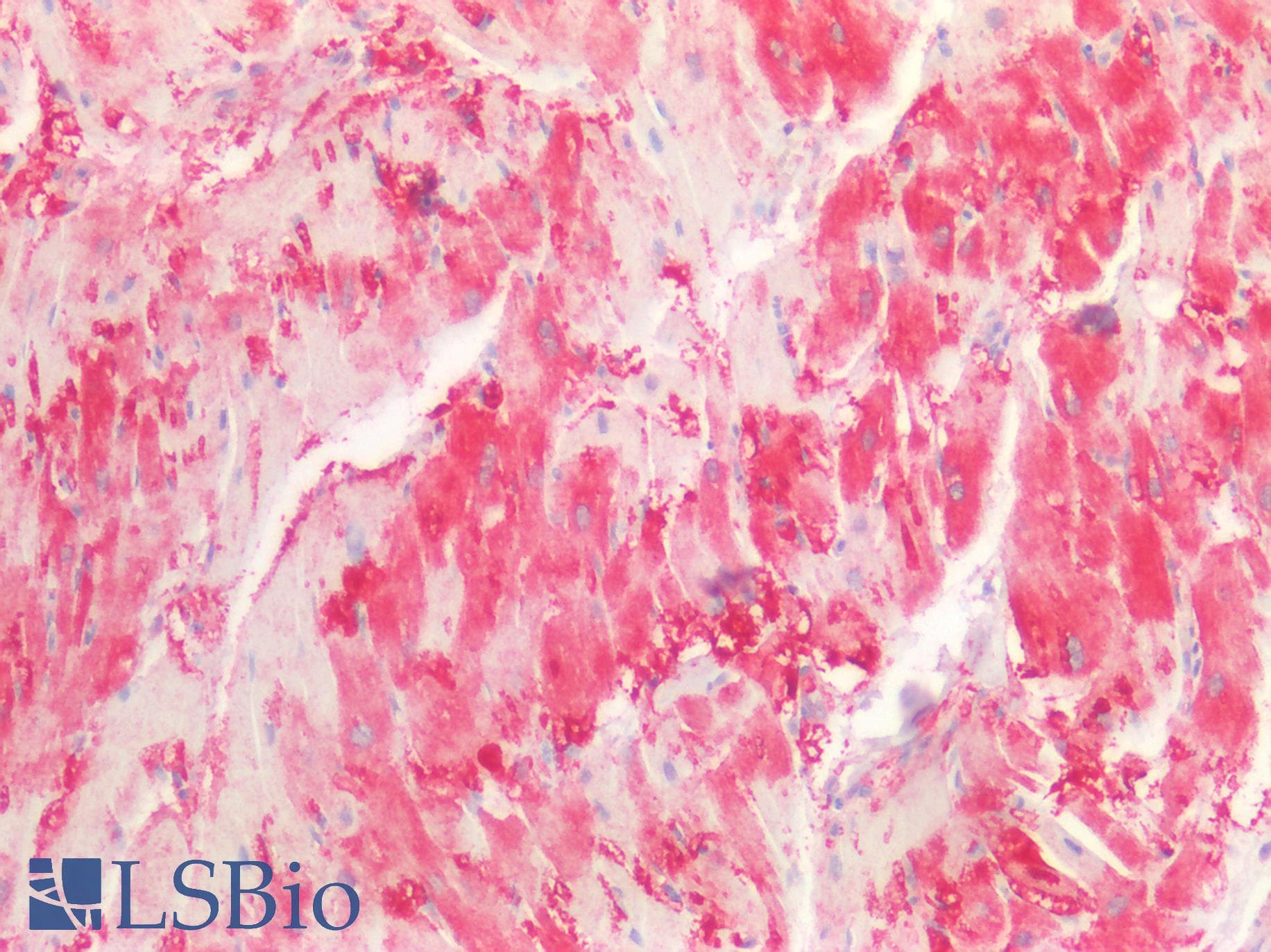 PathPlus™ GPBB / PYGB Antibody