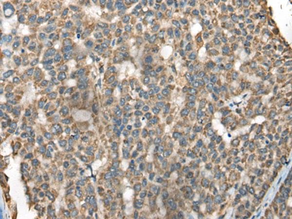 BLNK Antibody