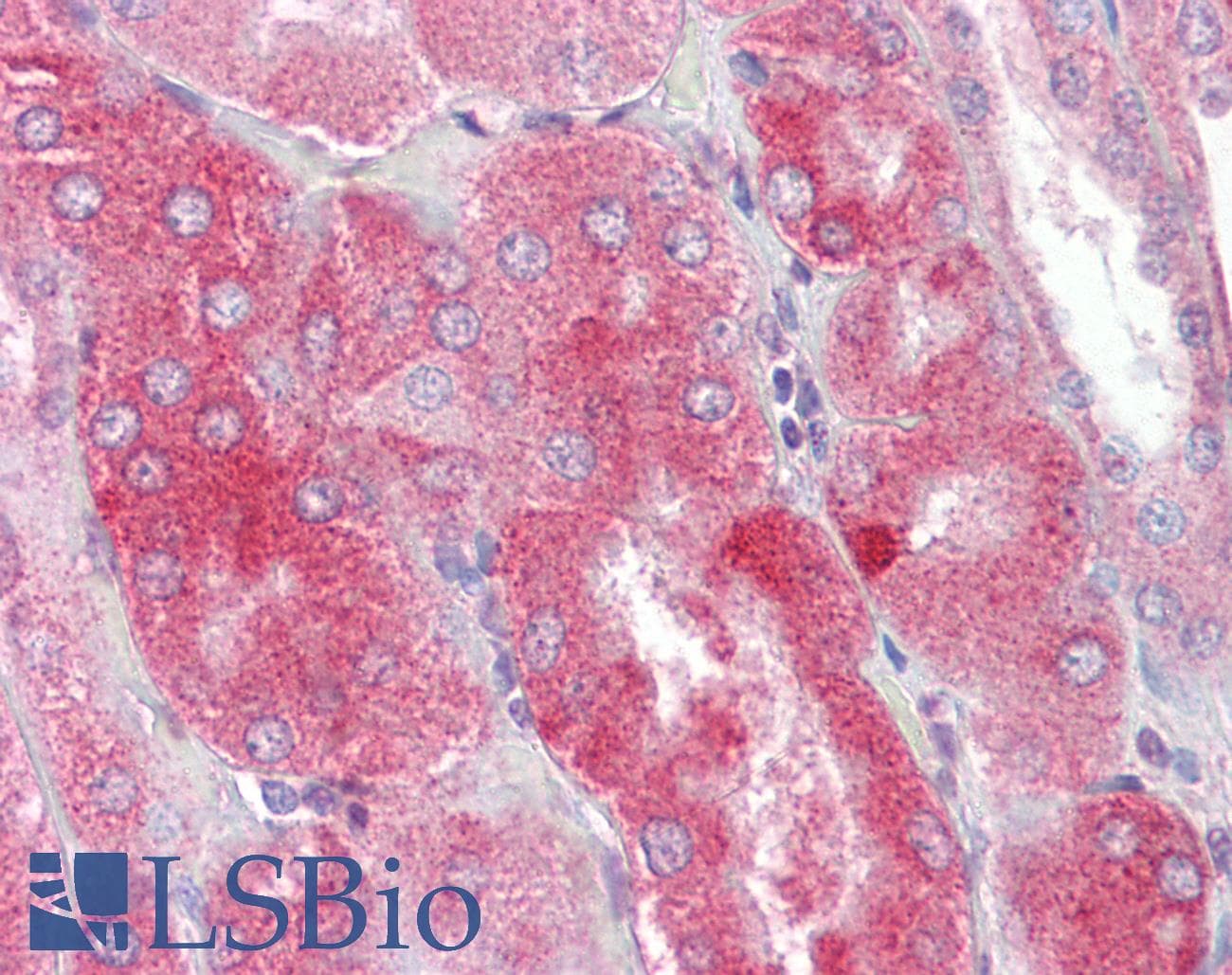 IHC-plus™ Polyclonal Rabbit anti-Human PRR5 Antibody (IHC, IF, WB)