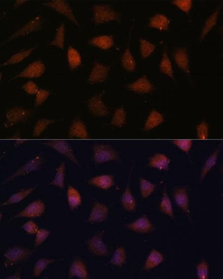 Polyclonal Rabbit anti-Human TREX1 Antibody (IF, WB)