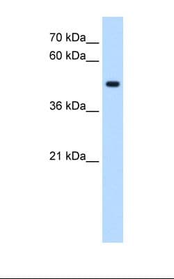 Polyclonal Rabbit anti-Human STYK1 Antibody (aa295-344, IHC, WB)