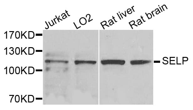 SELP / P-Selectin / CD62P Antibody