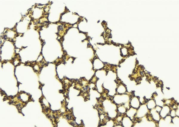CLDN7 / Claudin 7 Antibody