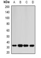 Polyclonal Rabbit anti-Human HAGH Antibody (IHC, IF, WB)