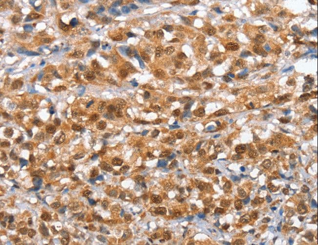 IRAK3 / IRAKM / IRAK-M Antibody