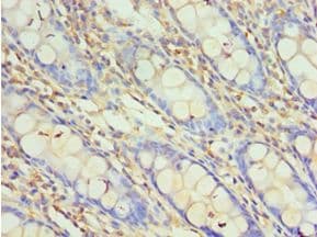 Polyclonal Rabbit anti-Human HOXA1 Antibody (aa75-205, IHC)