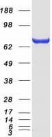 Human ACSS2 / ACAS2 Protein (Recombinant Myc-DDK (Flag))