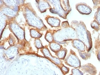 CGB / hCG Beta Antibody (clone HCGb/54 + HCGb/459, Ready-to-Use)