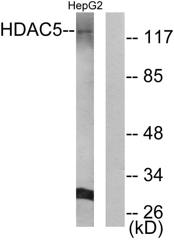 HDAC5 Antibody (Internal)