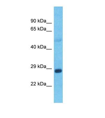 GRHL1 / TFCP2L2 Antibody (C-Terminus)