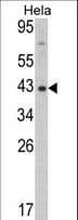 Polyclonal Rabbit anti-Human DNMT3L Antibody (aa389-421, WB)