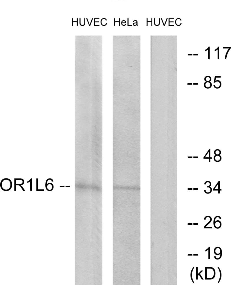 OR1L6 Antibody (aa111-160)