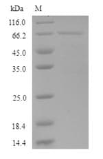Human KRT35 / Keratin 35 / KRTHA5 Protein (Recombinant 6His-SUMO, N-terminus)