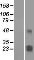 TMEM61 Protein (Over-Expression Lysate Myc-DDK (Flag))