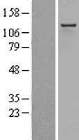 NRIP1 / RIP140 Protein (Over-Expression Lysate Myc-DDK (Flag))