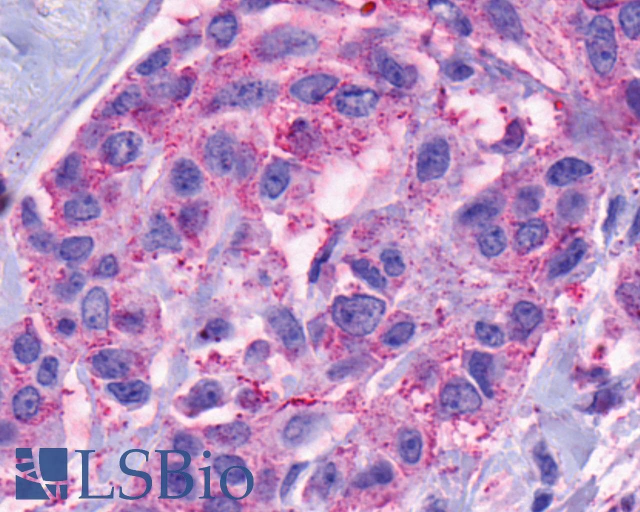 PathPlus™ TACR2 / NK2R Antibody (C-Terminus)