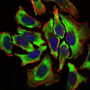 IHC-plus™ HAS2 Antibody (clone 4E7)
