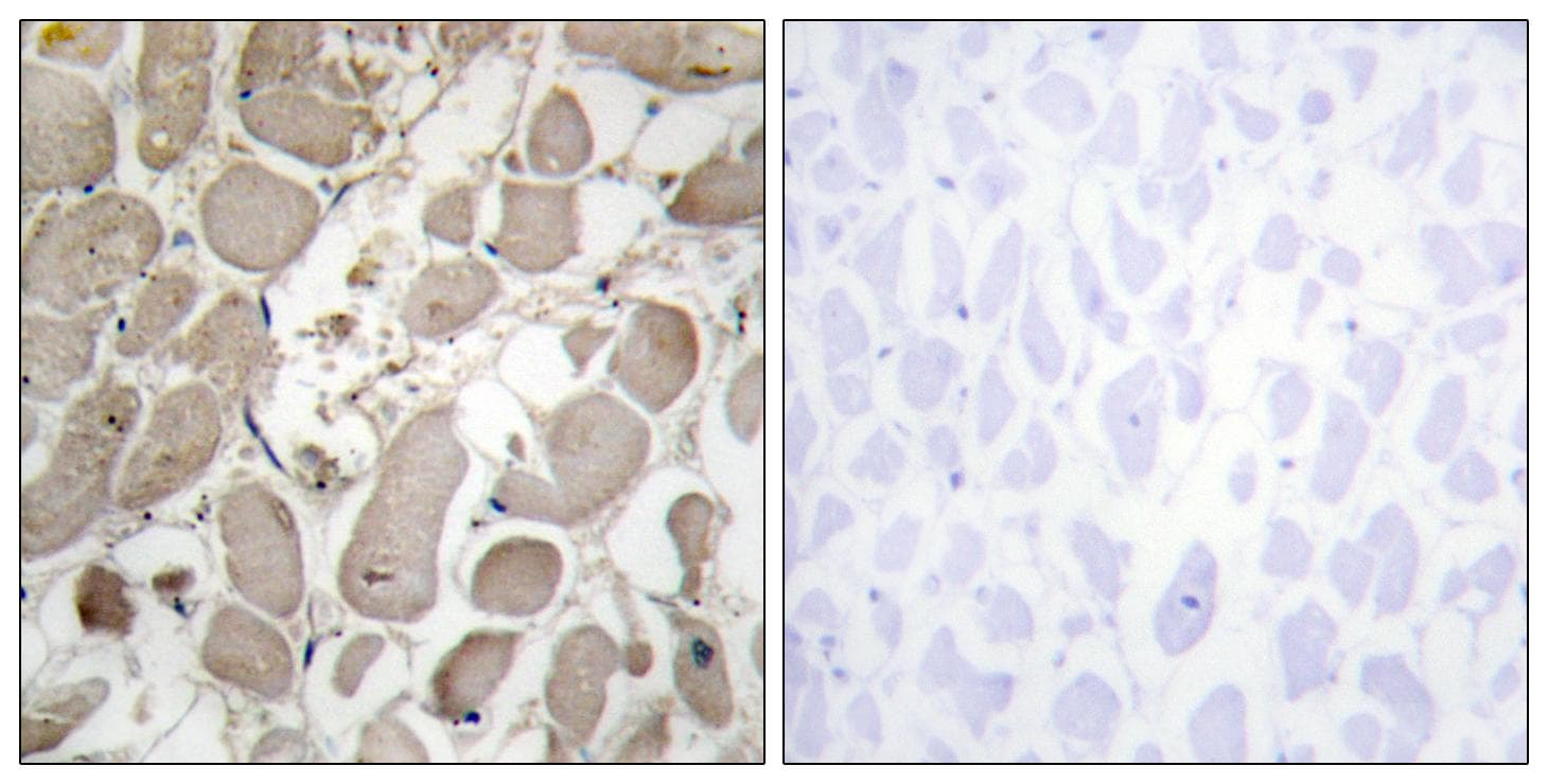 Polyclonal Rabbit anti-Human COL5A1 / Collagen V Alpha 1 Antibody (IHC, IF, WB)