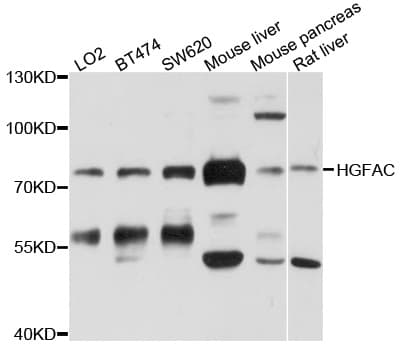 Polyclonal Rabbit anti-Human HGFAC / HGFA Antibody (WB)