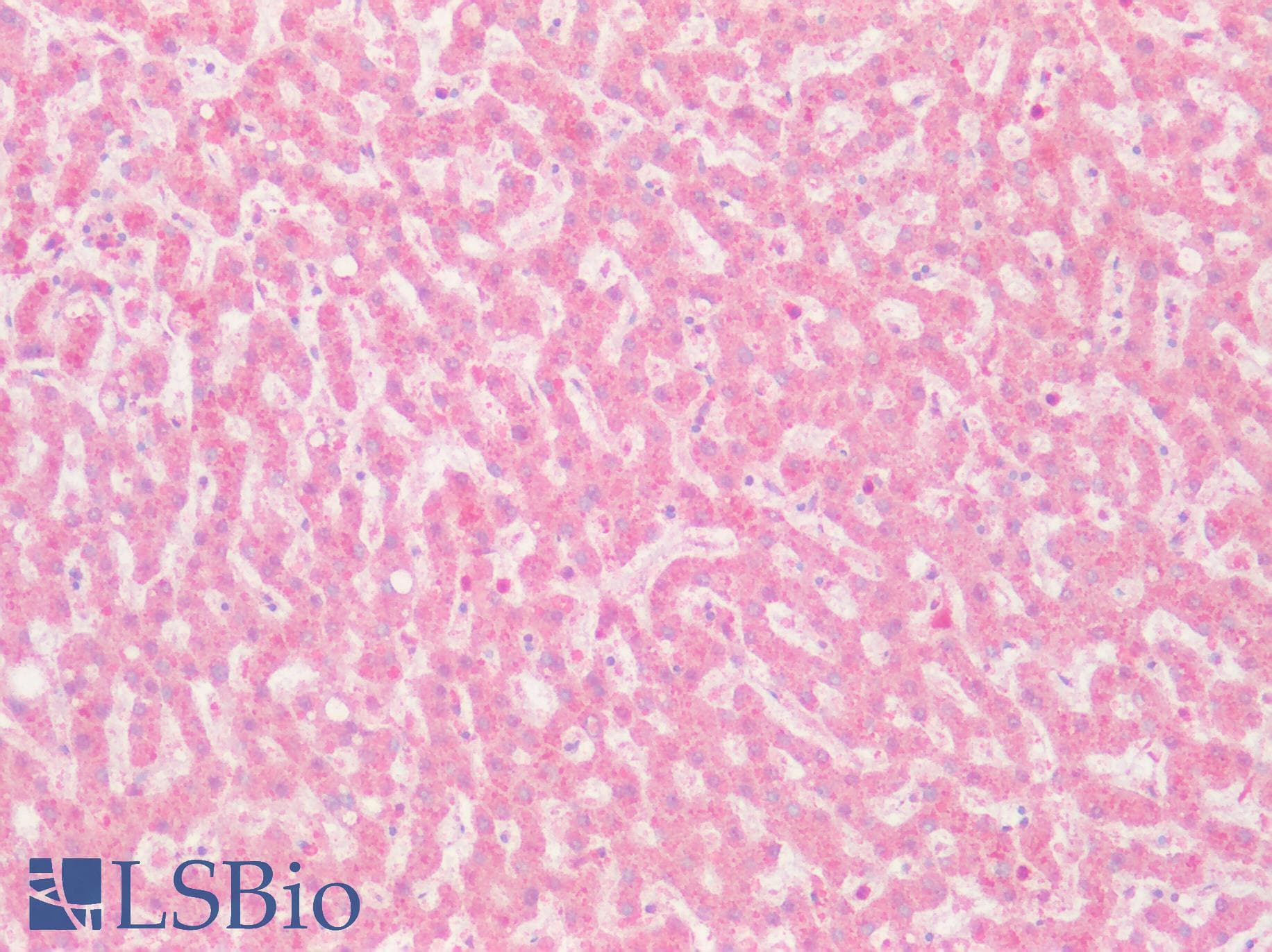 PathPlus™ GPRC5D Antibody (N-Terminus)