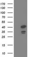 DNAJB1 / Hsp40 Antibody (clone OTI1A12)