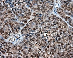 LTA4H / LTA4 Antibody (clone OTI7D11)