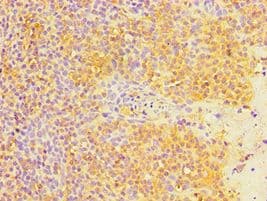 MTDH / Metadherin Antibody (aa1-260)