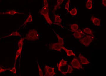 ACAT1 Antibody