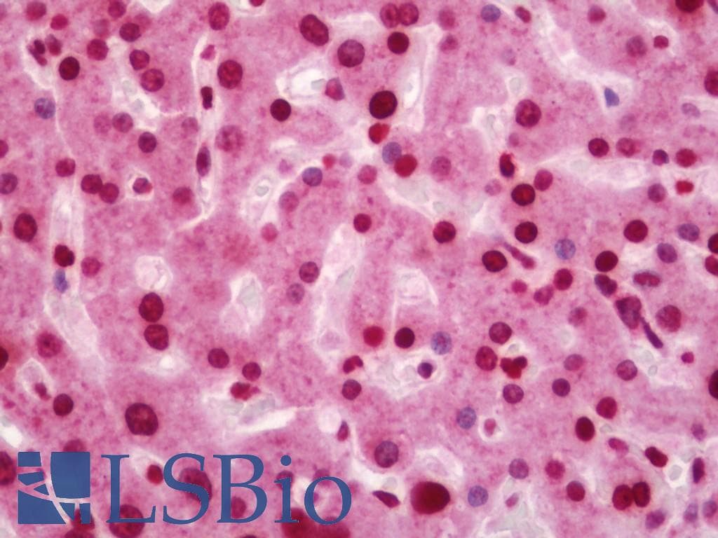IHC-plus™ Polyclonal Rabbit anti-Human TCEB3 / Elongin A Antibody (aa131-180, IHC, WB)