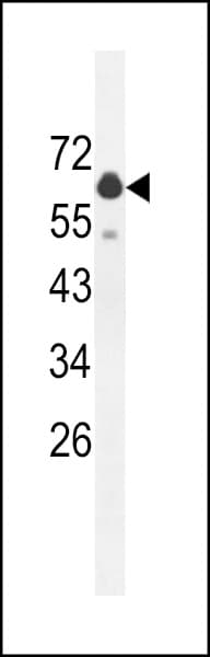 Polyclonal Rabbit anti-Human GLS2 / Glutaminase 2 Antibody (aa498-524, IHC, WB)