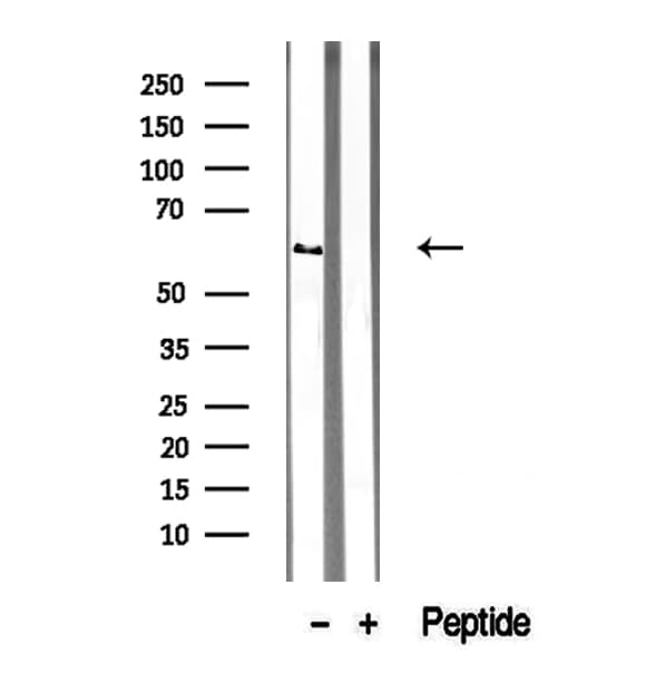 Polyclonal Rabbit anti-Human SPRING / TRIM9 Antibody (IHC, IF, WB)