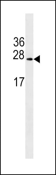 EPO / Erythropoietin Antibody (aa20-48)