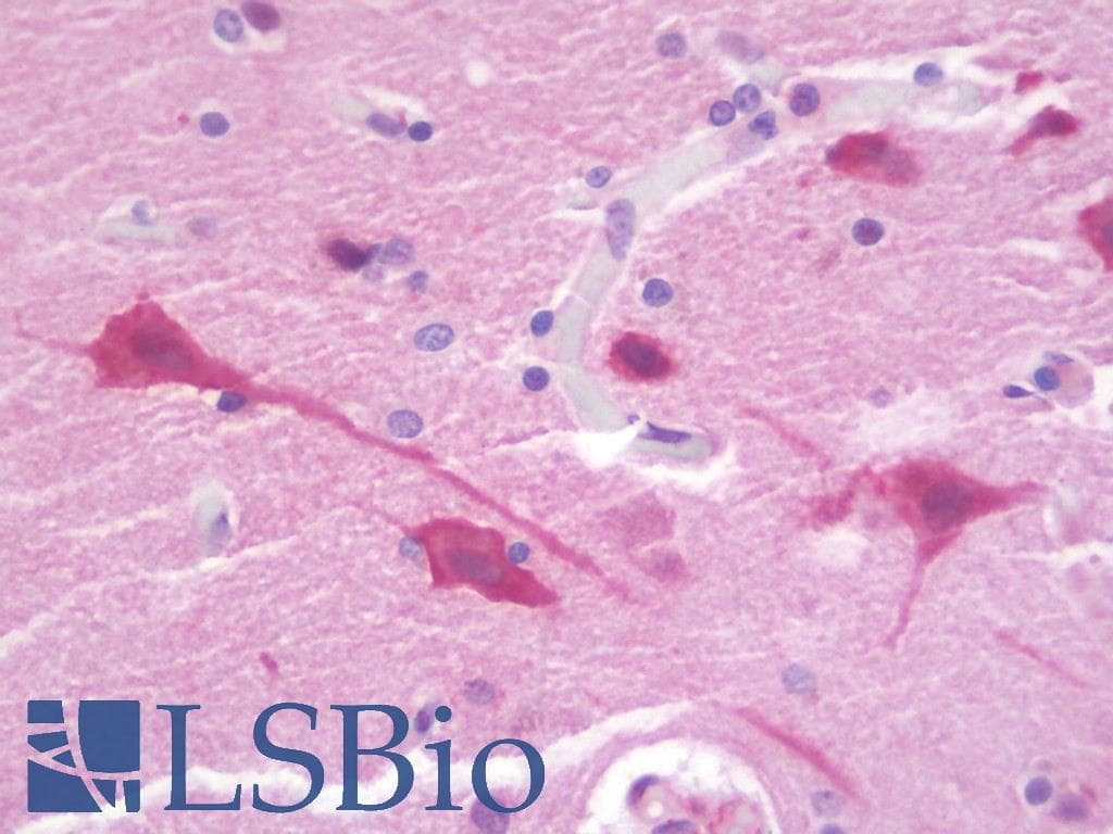 IHC-plus™ Polyclonal Rabbit anti-Human MARCH3 Antibody (aa111-160, IHC, WB)