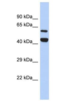 YME1L1 Antibody (aa422-471)