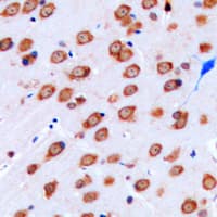 Polyclonal Rabbit anti-Human KCNJ9 / Kir3.3 / GIRK3 Antibody (Internal, IHC, WB)