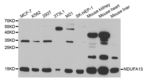 IHC-plus™ NDUFA13 / GRIM19 Antibody