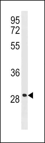 Polyclonal Rabbit anti-Human LRRC61 Antibody (aa111-139, WB)
