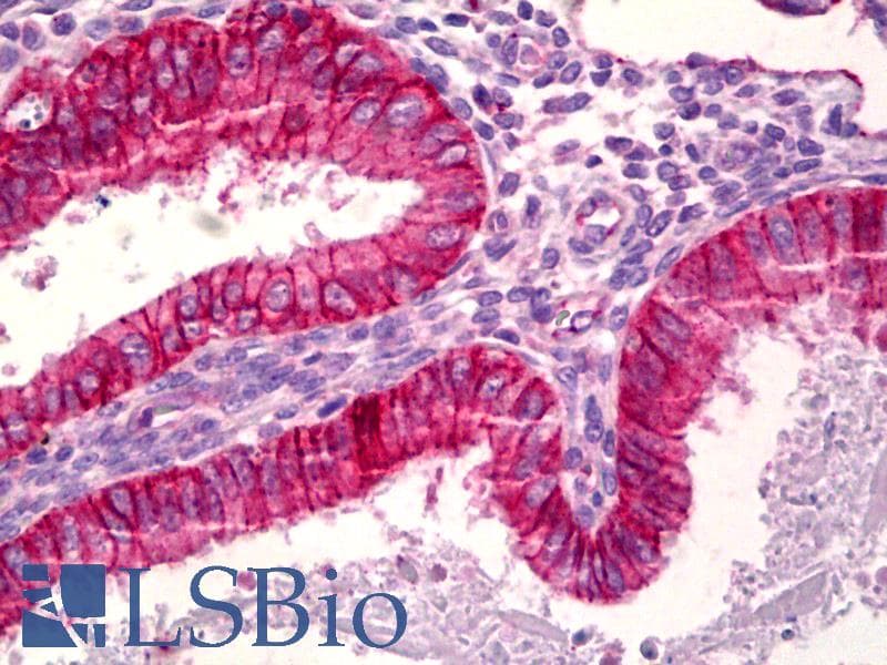 PathPlus™ Polyclonal Rabbit anti-Human BAX Antibody (aa1-50, IHC, IF, WB)