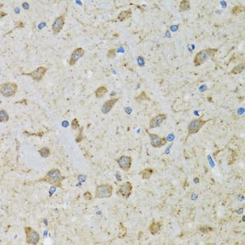 DHRS2 / HEP27 Antibody
