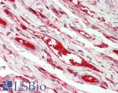 FGA / Fibrinogen Alpha Antibody (aa124-214)