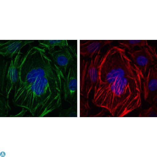 ACTA2 / Smooth Muscle Actin Antibody