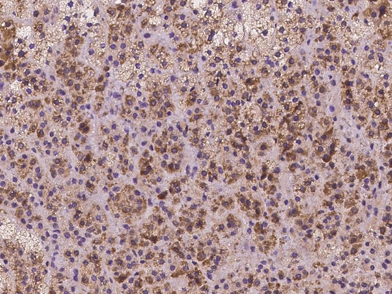 Polyclonal Rabbit anti-Human CLPB Antibody (IHC)