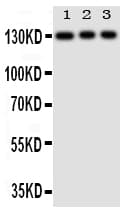 TLR10 Antibody (aa88-102)