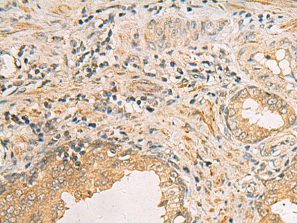 IDS / Iduronate 2 Sulfatase Antibody